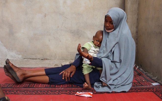 Tchad: Médecins Sans Frontières tire la sonnette d’alarme sur la malnutrition infantile dans la province du Hadjer Lamis